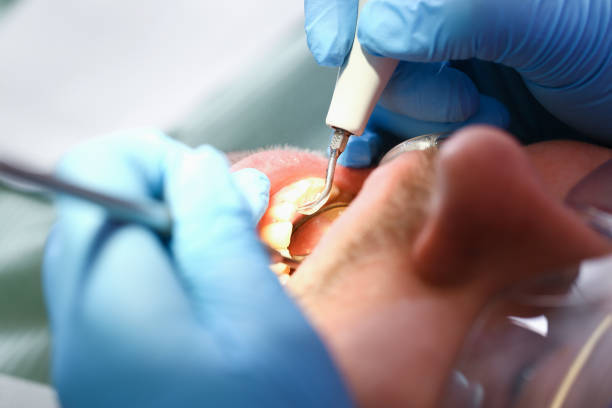 Best Weekend Emergency Dentist in New Bern, NC