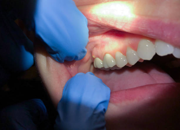Best Emergency Cosmetic Dentistry in New Bern, NC