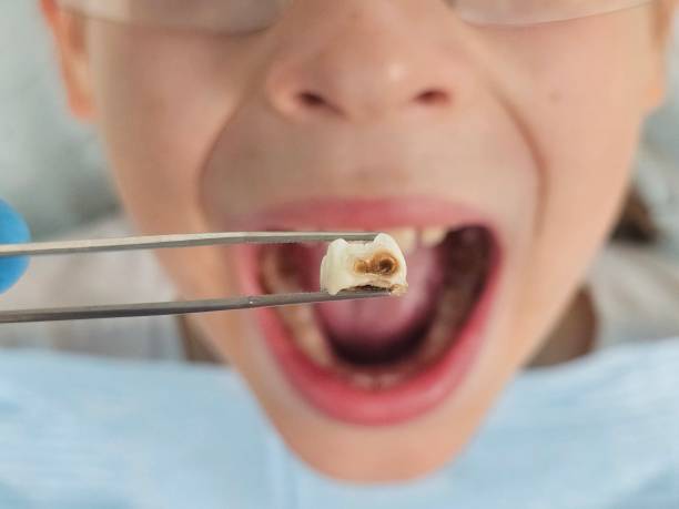 Best Emergency Dentist for Knocked-Out Tooth in New Bern, NC